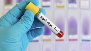 Không chủ quan với dịch bệnh do virus Nipah